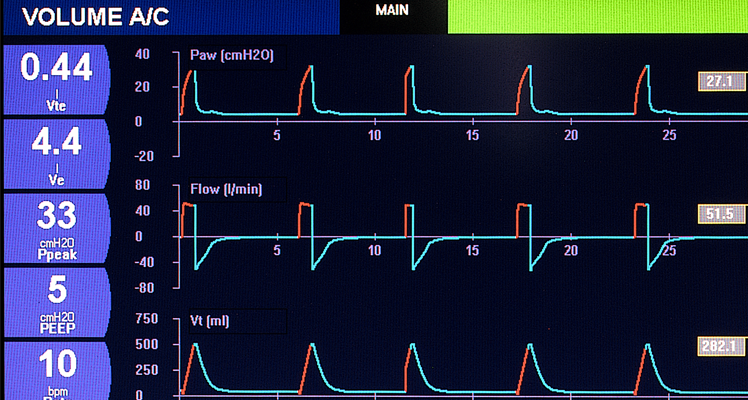 mechanical ventilator screen