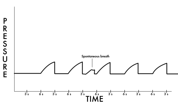 Guided Breathing (3 rounds with onscreen timer) 